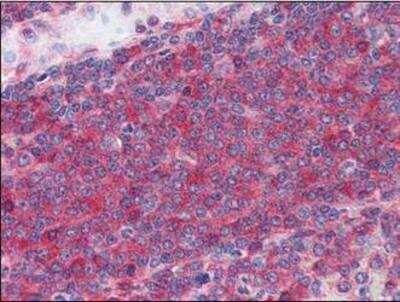 Immunohistochemistry-Paraffin: CaMKIIN2 [p Thr286] Antibody [NBP1-50259] - Analysis of anti-CAMK2 antibody with human spleen.